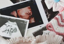 breech presentation in pregnancy